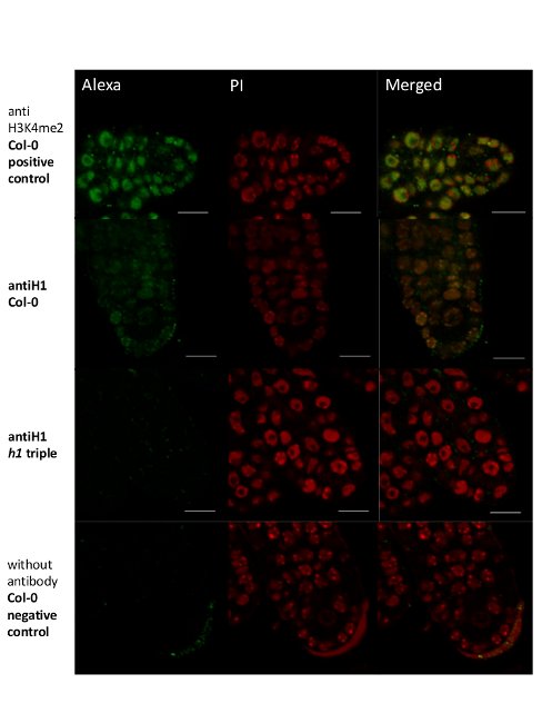 immunolocalization in plant tissue using anti-H1 antibodies